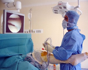 arthroscopie